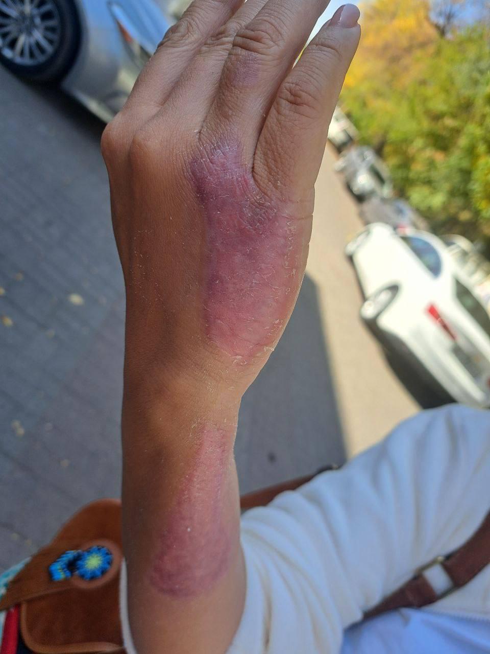 Избитая и изнасилованная бишкекчанка